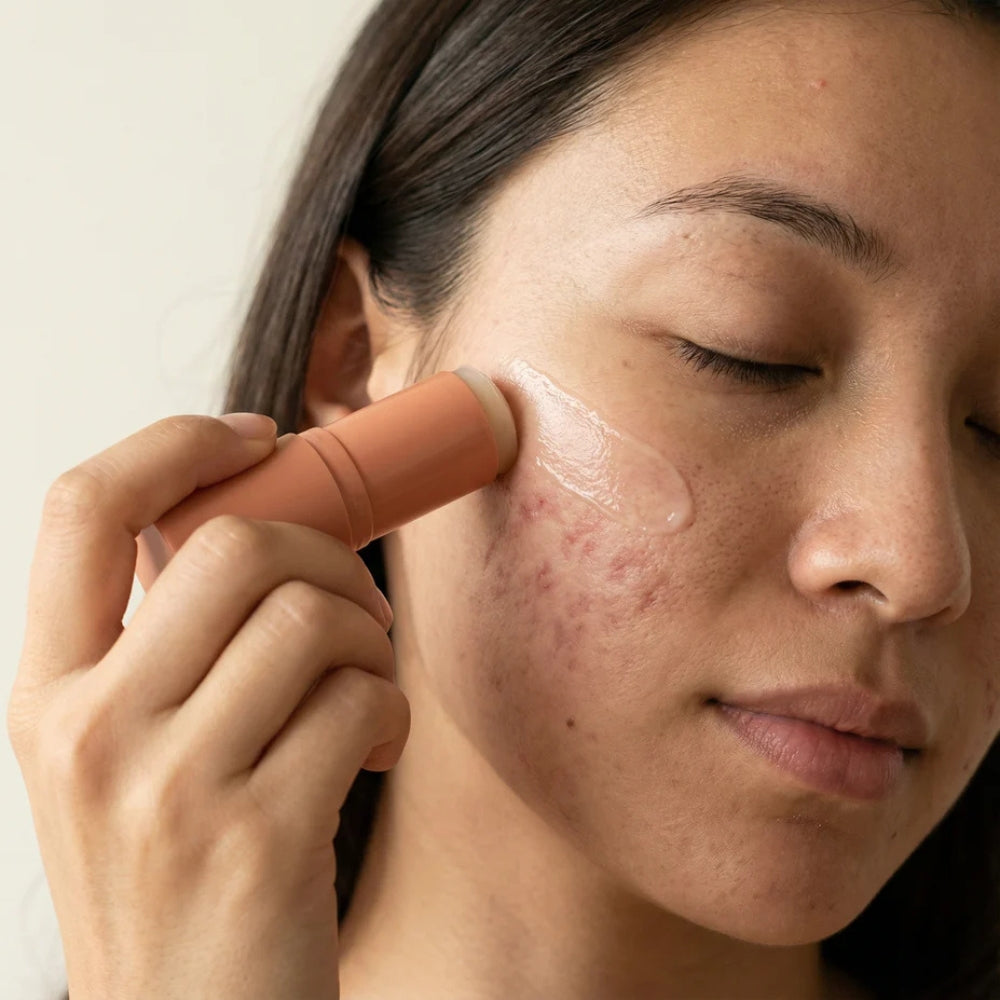 Stick Clinico per il Trattamento delle Cicatrici da Acne